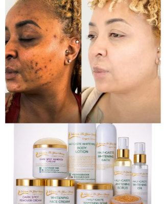 HALF-CASTE WHITENING FULL SET