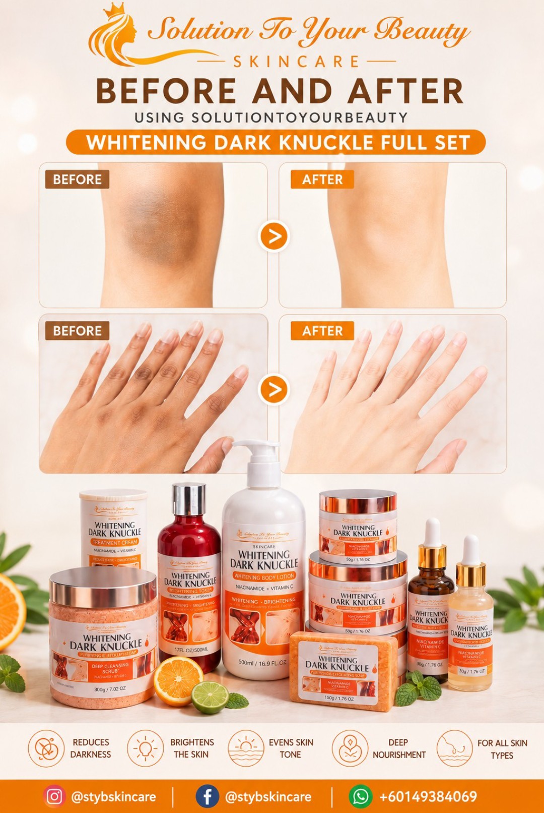WHITENING DARK KNUCKLE TREATMENT SET