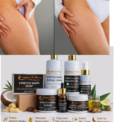 STRETCH MARKS  TREATMENT SET