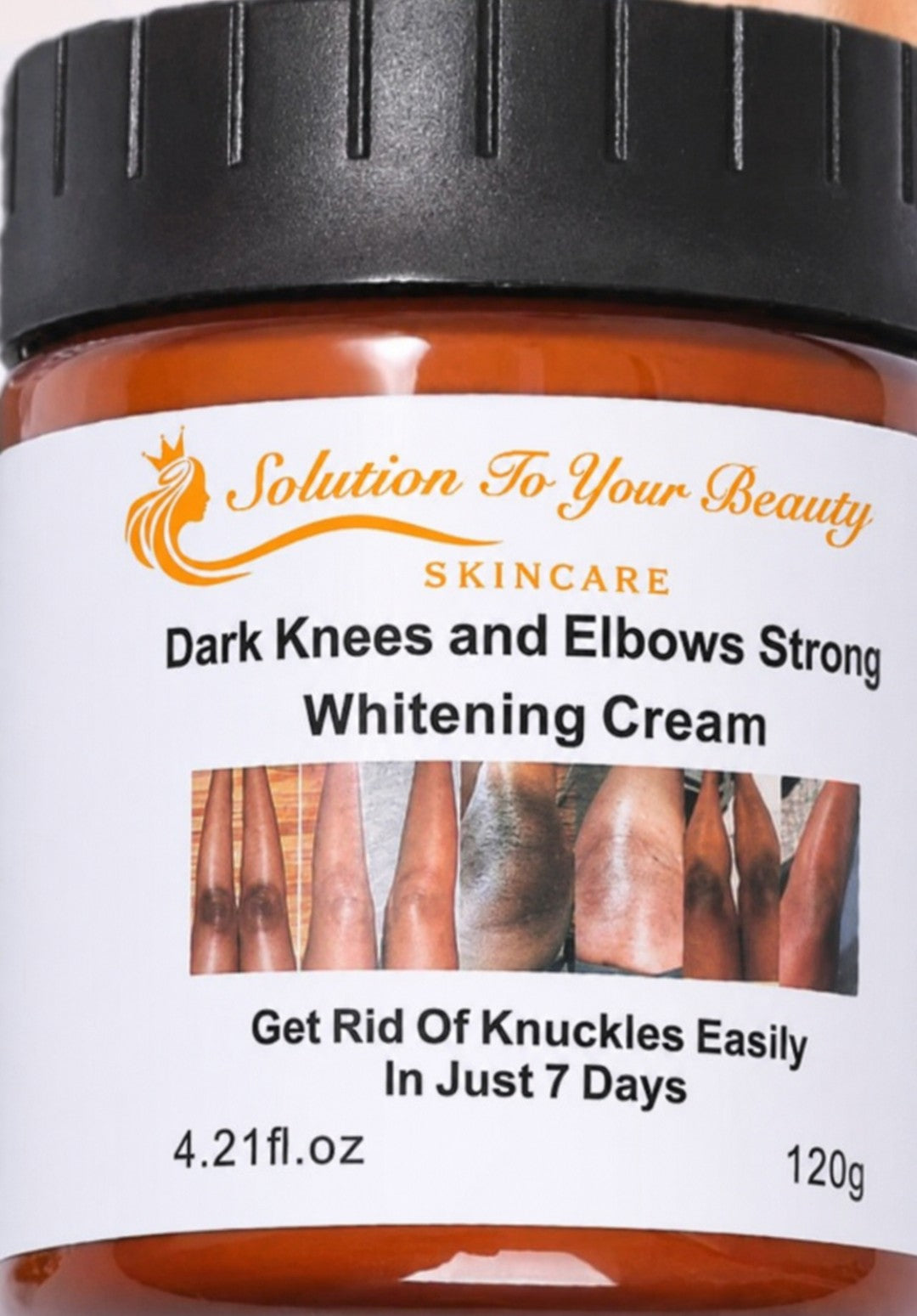 DARK KNEES and ELBOWS STRONG WHITENING CREAM