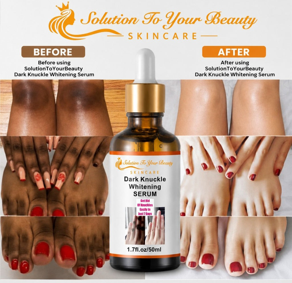 DARK KNUCKLE WHITENING SERUM