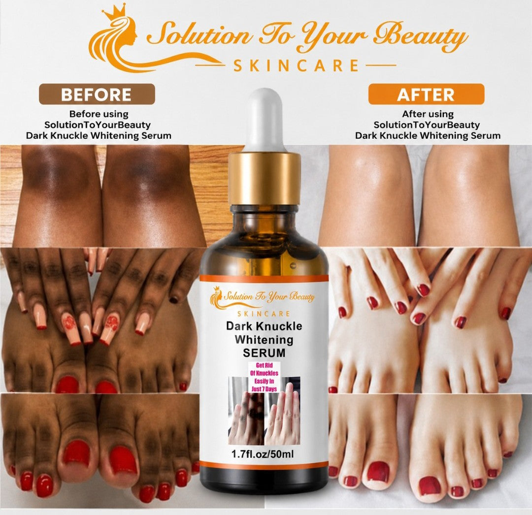 DARK KNUCKLE WHITENING SERUM