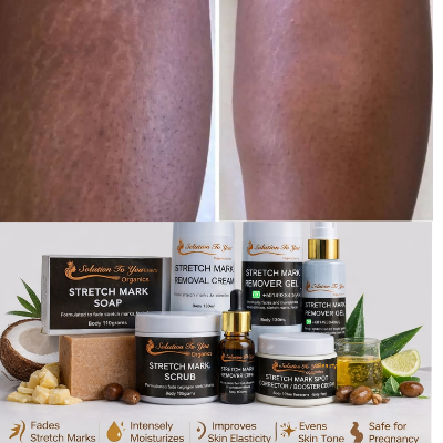 STRETCH MARKS  TREATMENT SET